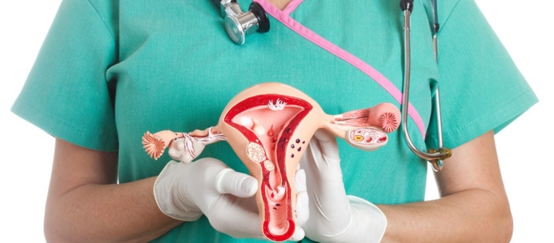 Inseminação intrauterina
